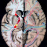 Vintage anatomical illustration of the human brain