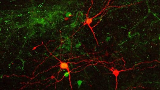 Fluorescence microscopy image of neurons in red and green