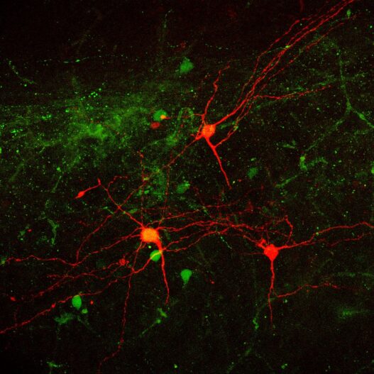 Fluorescence microscopy image of neurons in red and green