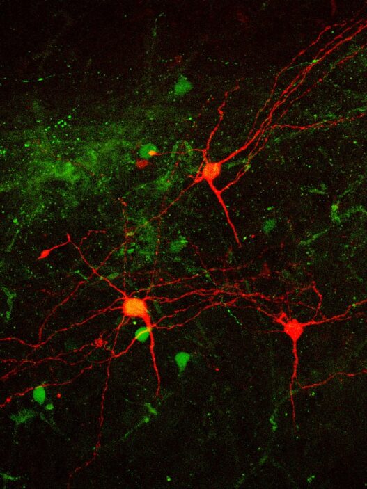 Fluorescence microscopy image of neurons in red and green